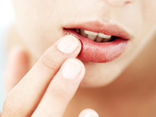 Ulcer Ayurvedic Treatment Bangalore India